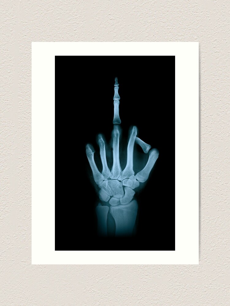 &ldquo;cool middle finger xray, x-ray photo, black&rdquo; Art Print by Kinisis