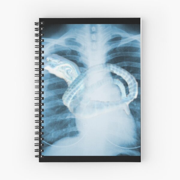 Item preview, Chestburster X-Ray designed and sold by Bart Reardon.