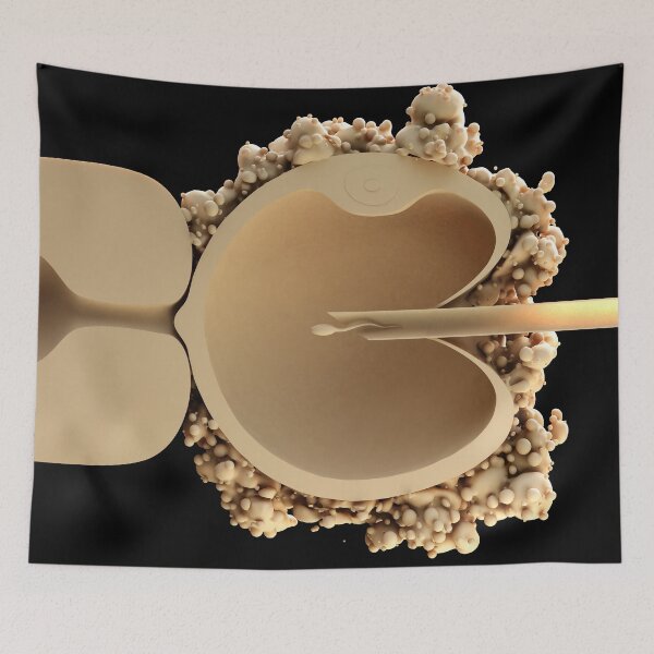 Item preview, ICSI in vitro fertilisation designed and sold by MDeAngelis.