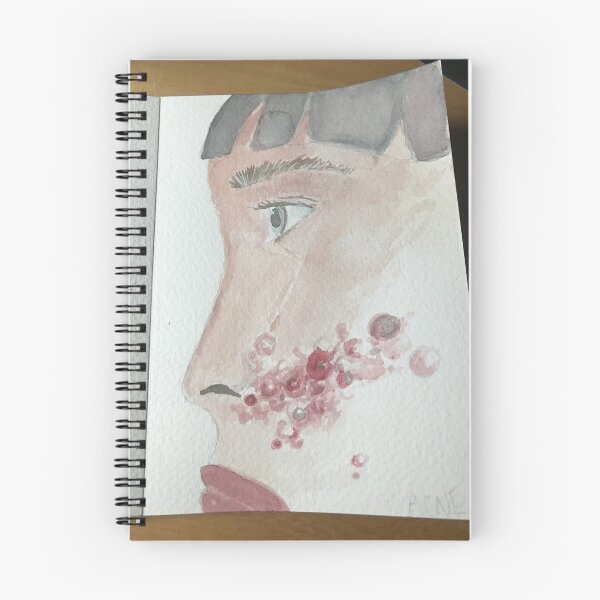 Item preview, Acne designed and sold by Circusoflight.