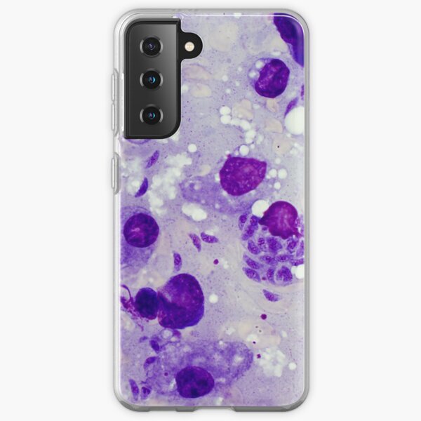 Toxoplasma gondii - a protozoan parasite Samsung Galaxy Soft Case
