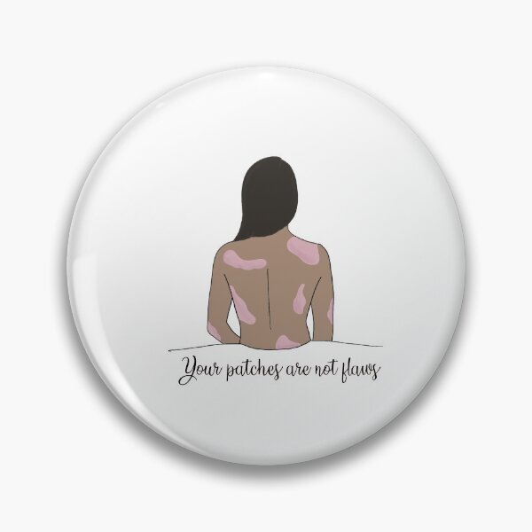 Item preview, Your Patches are Not Flaws designed and sold by restingitchface.