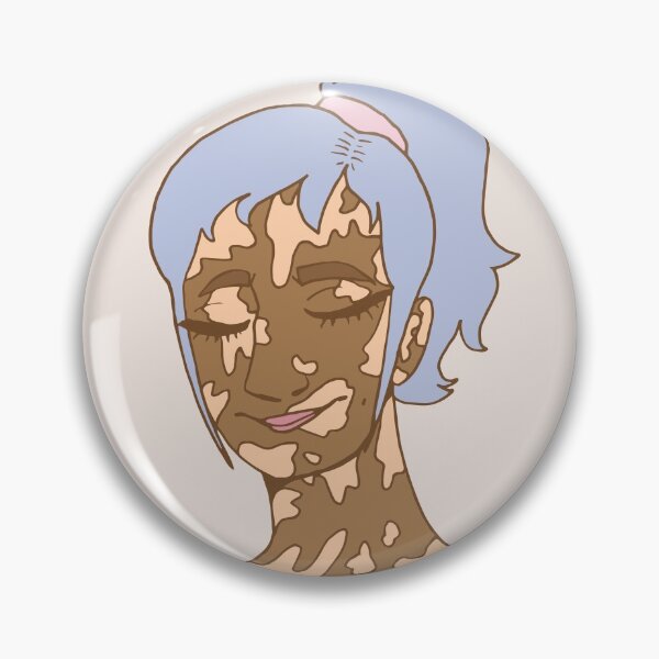Item preview, A Girl with Purple Hair and Vitiligo designed and sold by miartist.