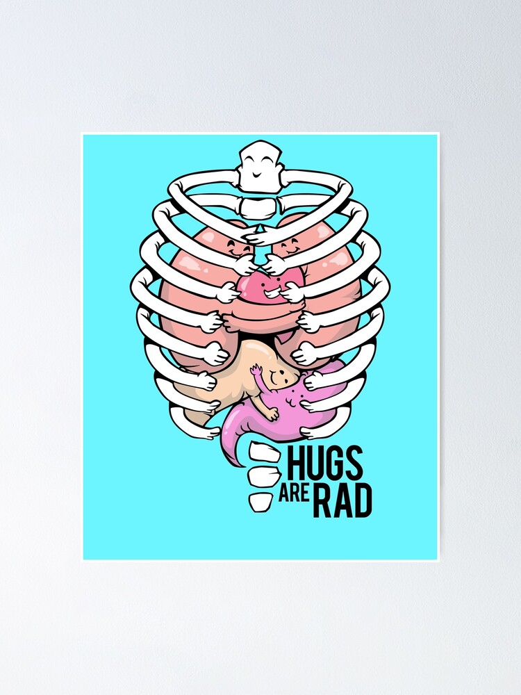 Hugs Are Rad Radiology X Ray Tech Appreciation Hugging Skeleton Drawing Poster For Sale By 7066