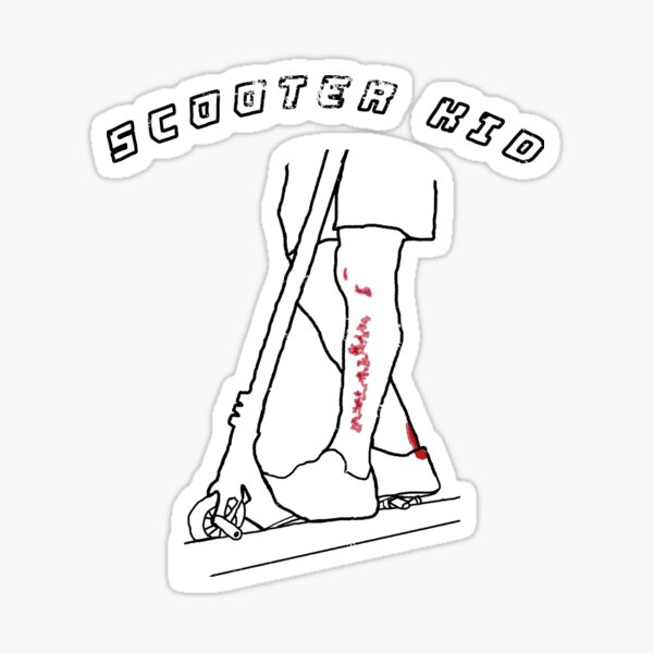  Street  Scooter  Stickers  Redbubble