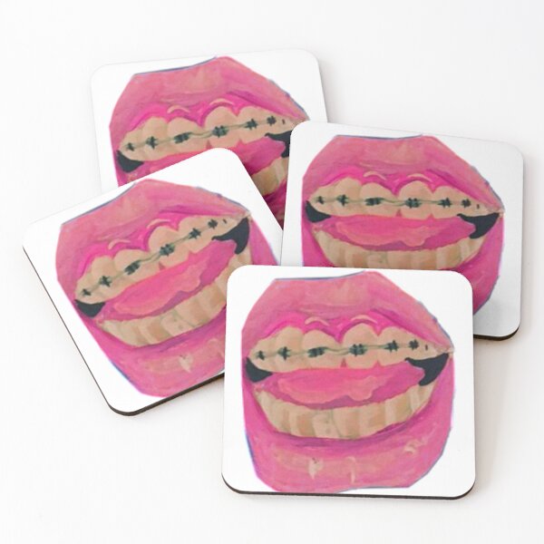Item preview, Braces designed and sold by t00thfarm.