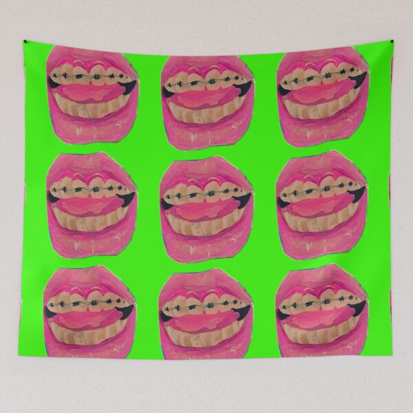 Item preview, Braces designed and sold by t00thfarm.
