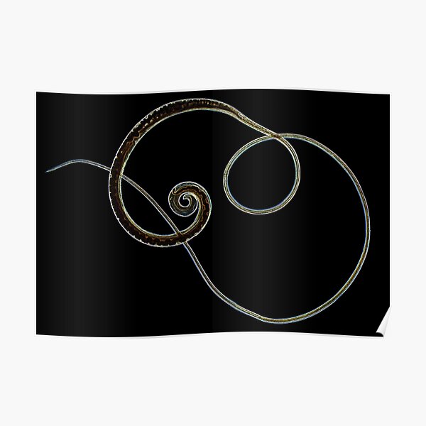 Trichuris trichiura Poster