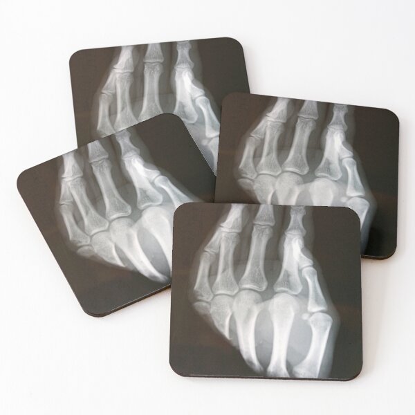 Item preview, Mano de rayos x designed and sold by picturetom.