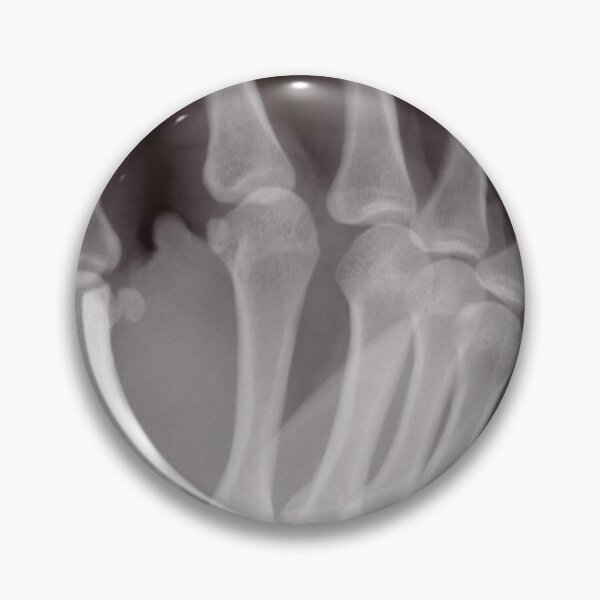 Item preview, X-ray image of a hand designed and sold by picturetom.