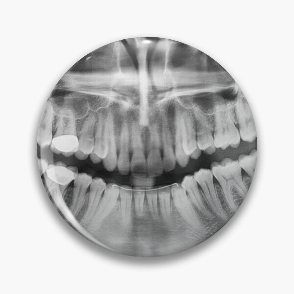 Item preview, x-ray designed and sold by underground notes.