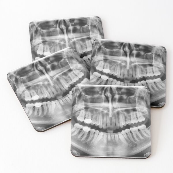 Item preview, x-ray designed and sold by underground notes.