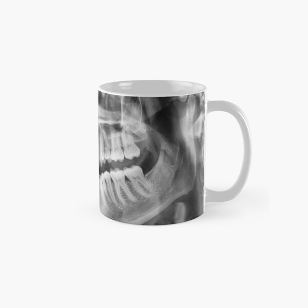 Item preview, x-ray designed and sold by underground notes.