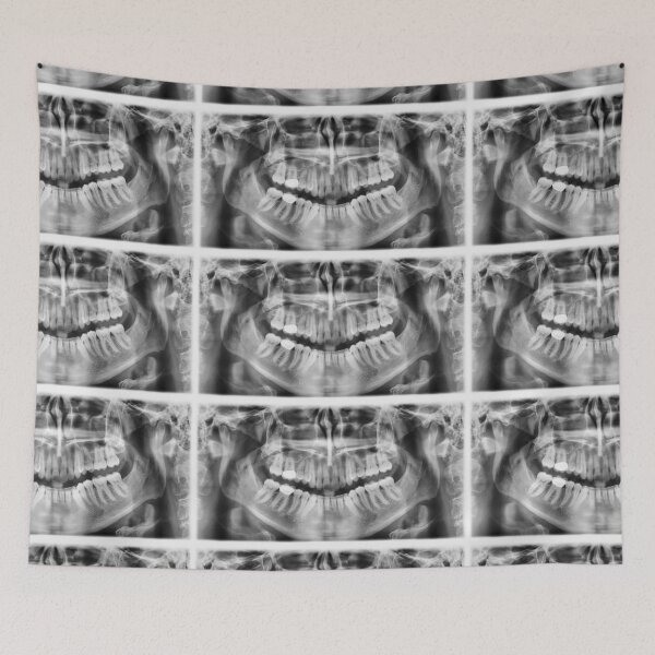 Item preview, x-ray designed and sold by underground notes.
