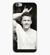 James Franco iPhone Case