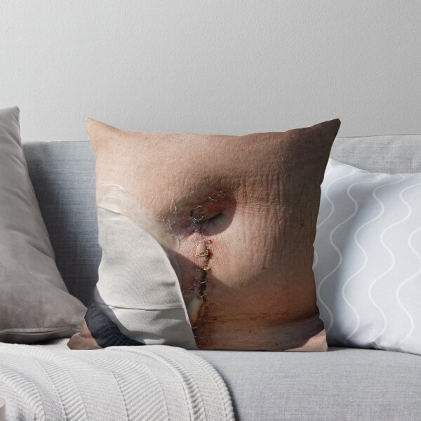 Item preview, stoma after bowel surgery  designed and sold by Claraveritas.