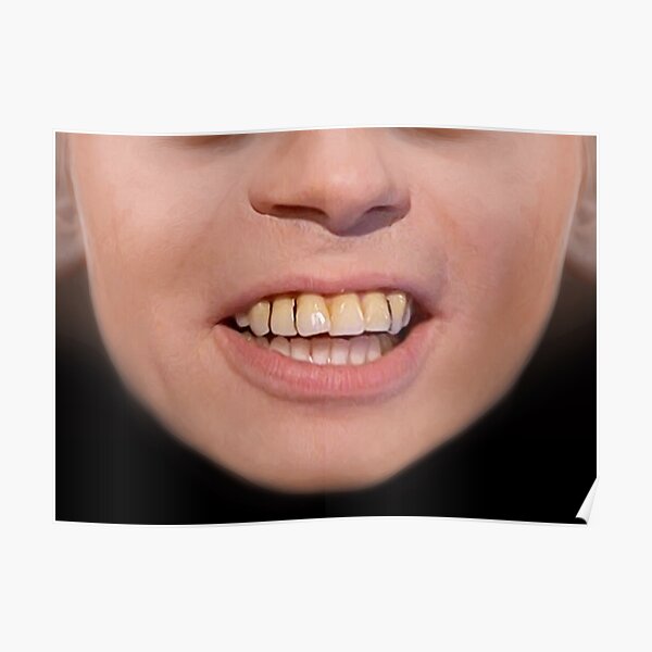 “Bad teeth Smile Face mask.” Poster for Sale by mavisshelton | Redbubble