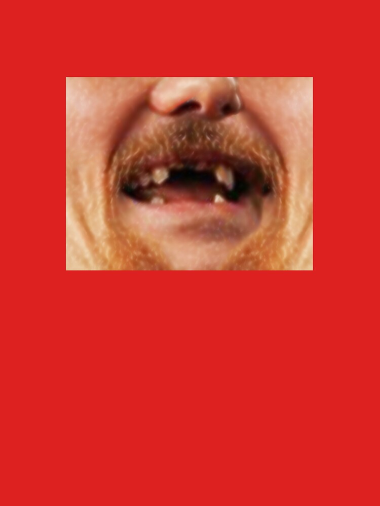 Stanley Cup Finals: Duncan Keith's Missing Teeth