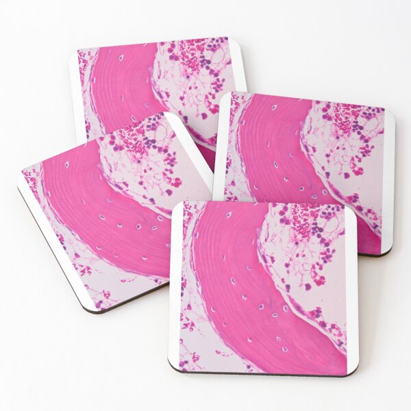 Item preview, Spongy bone designed and sold by Love Histology.