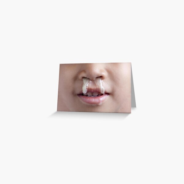 funny face gross snot nose kid Greeting Card