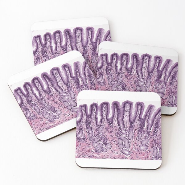 Item preview, Pyloric stomach designed and sold by Love Histology.