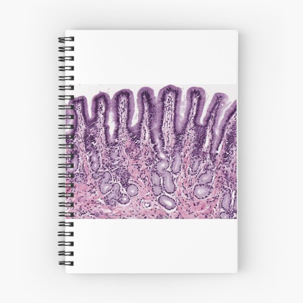 Item preview, Pyloric stomach designed and sold by Love Histology.