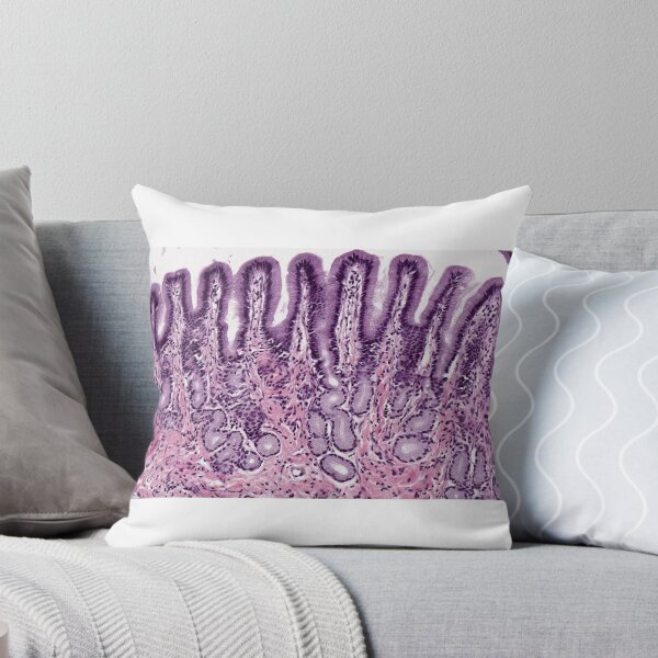 Item preview, Pyloric stomach designed and sold by Love Histology.