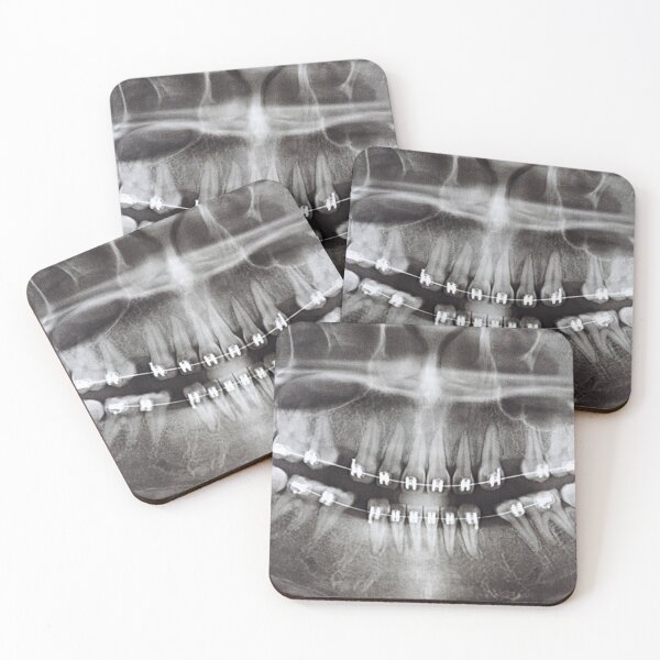 Item preview, panoramic-dental-x-ray designed and sold by neteor.