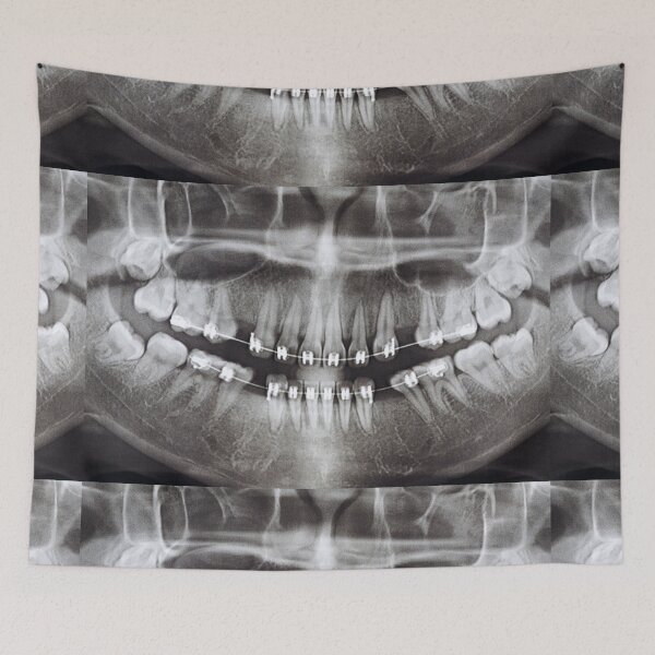 Item preview, panoramic-dental-x-ray designed and sold by neteor.