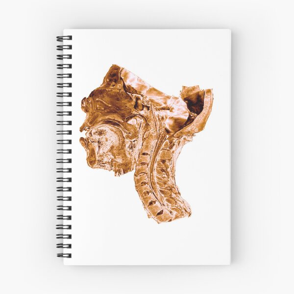 Artikelvorschau, Menschliches Gehirn Roségold - Hals entworfen und verkauft von uberanatomy.