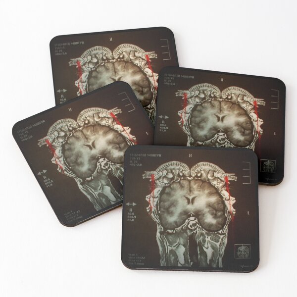 Item preview, Stigmata Martyr Brain Homunculus designed and sold by Super-Pinhead.