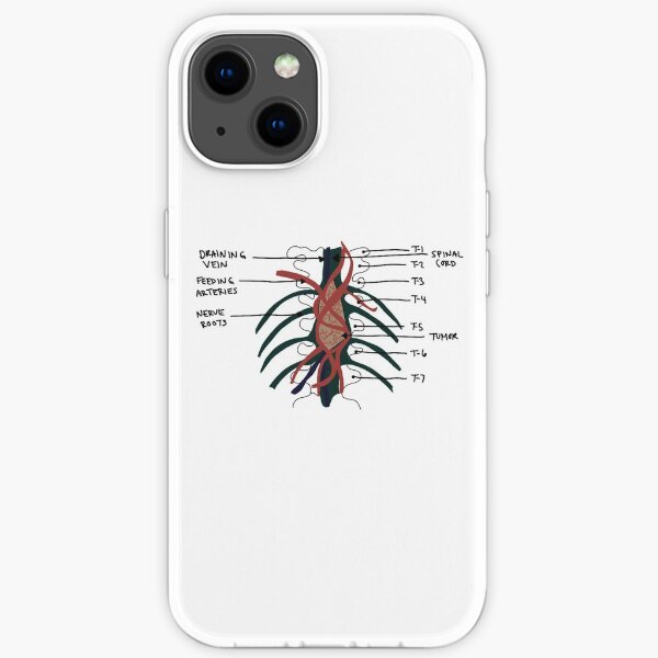 Greys Anatomietumor iPhone Flexible Hülle
