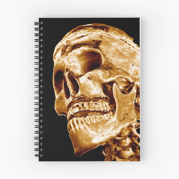 Item preview, Head of Human Skeleton - Rose Gold - Classic Black Background designed and sold by uberanatomy.