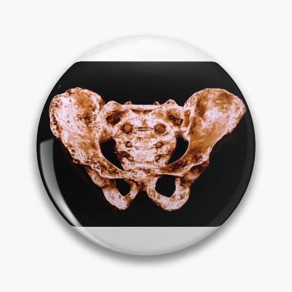 Artikelvorschau, Design der menschlichen Hüfte - Roségold entworfen und verkauft von uberanatomy.