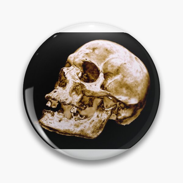 Artikelvorschau, Design eines menschlichen Schädels – Gold – klassischer schwarzer Hintergrund entworfen und verkauft von uberanatomy.