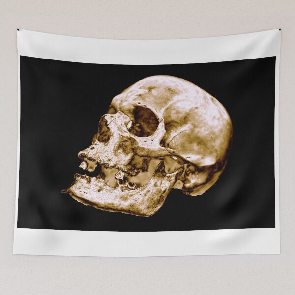 Item preview, Diseño de calavera humana - Dorado - Fondo negro clásico designed and sold by uberanatomy.