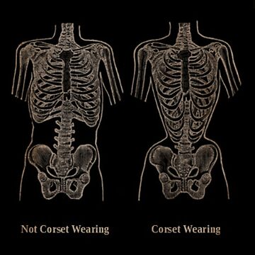 Skeleton in Corsets | Art Print