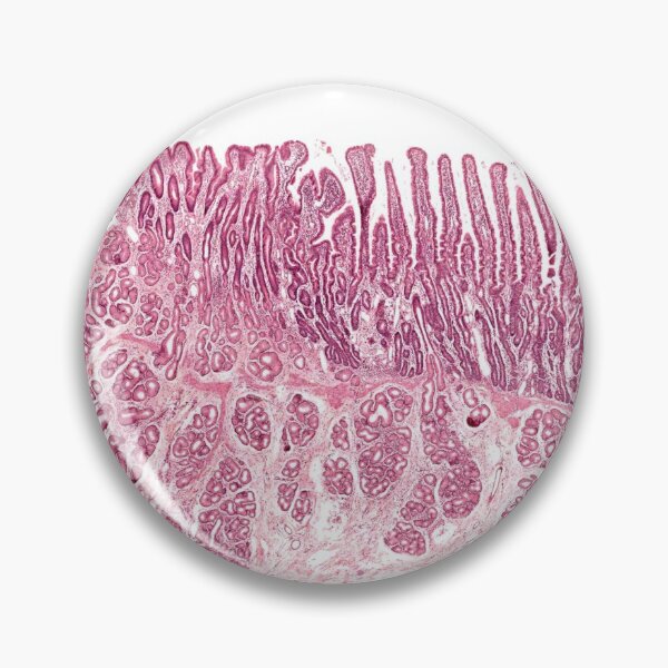 Item preview, Gastroduodenal Junction designed and sold by Love Histology.