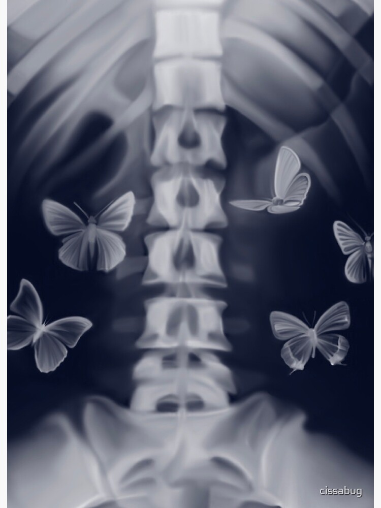 Featured image of post Butterflys In Stomach To have butterflies in your stomach means to feel nervous or anxious and have a queasy or fluttering feeling in your gut
