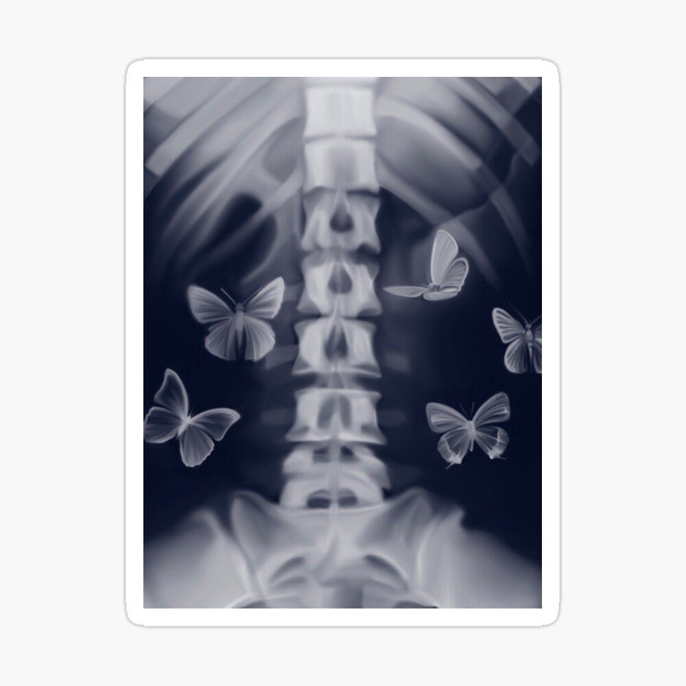 X-ray Stomach Butterflies Digital Art