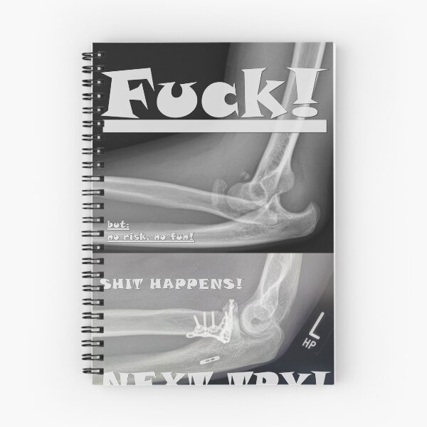 Item preview, broken / fixed bone - no risk, no fun designed and sold by Ofen69.