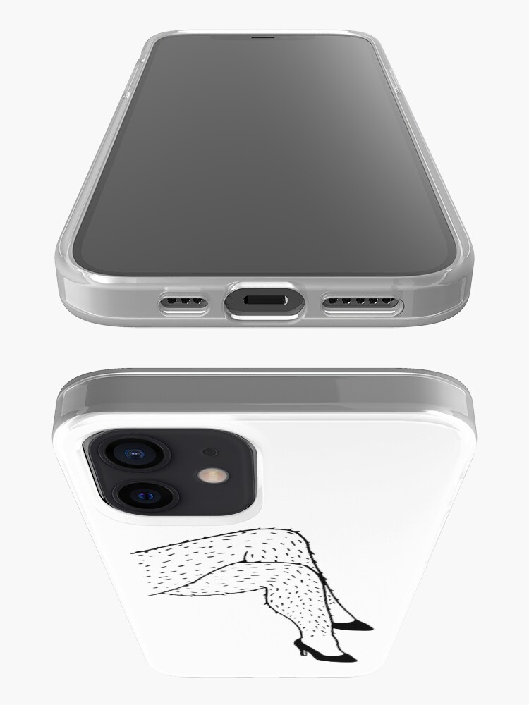 Alternate view of Hairy Legs iPhone Case & Cover