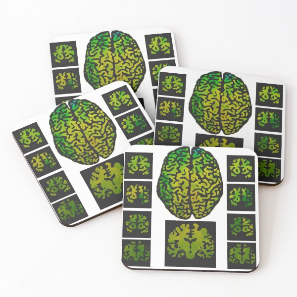 Item preview, Brain Scanning Imaging Greeting Card designed and sold by jaml-12.