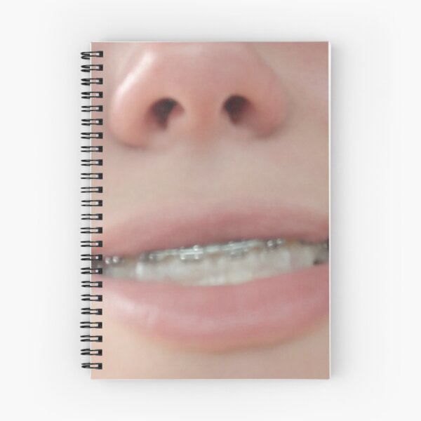 Item preview, Smile with Braces  designed and sold by IndyOnly.
