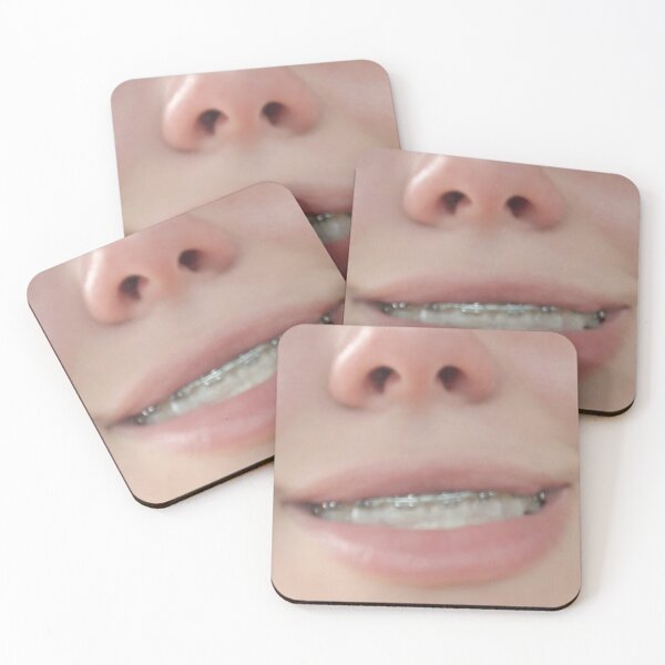 Item preview, Smile with Braces  designed and sold by IndyOnly.
