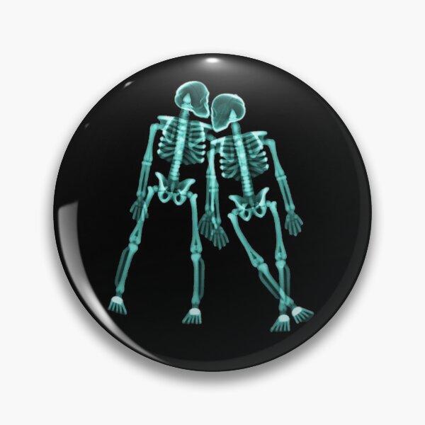 Item preview, Xray of Skeleton Couple, Blue Light designed and sold by xrayjessie.