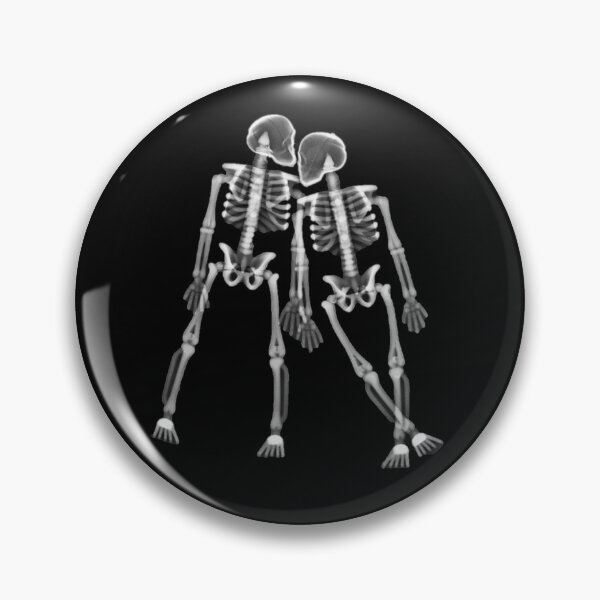 Item preview, Xray of Skeleton Couple, Original Black/White designed and sold by xrayjessie.