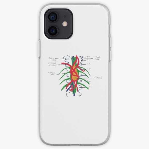 Tumeur sur le mur Coque souple iPhone