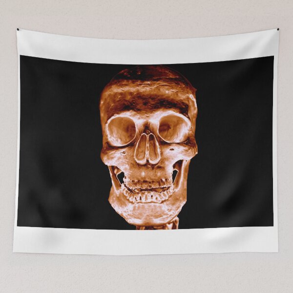 Item preview, Skull - Rose Gold - Classic Black Background designed and sold by uberanatomy.