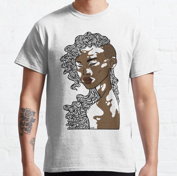 Vitiligo Classic T-Shirt
